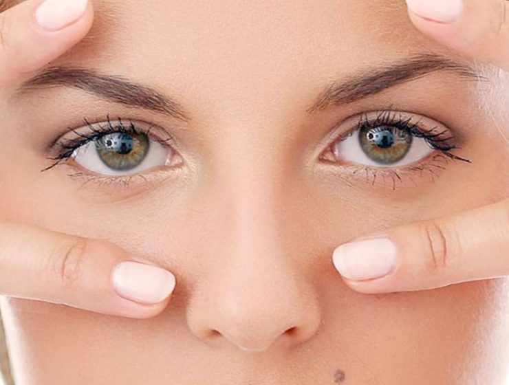 Problemi Palpebrali: Guida alla Blefaroplastica