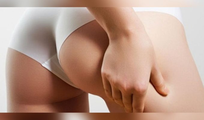 Tecniche per combattere cellulite