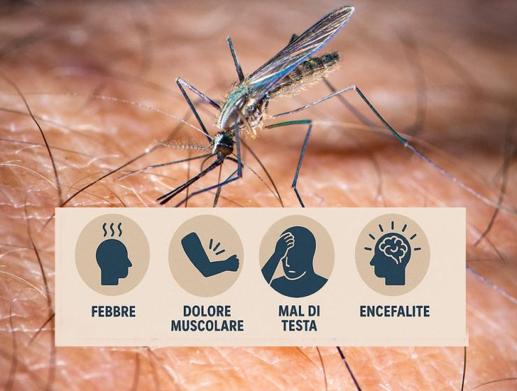 Febbre West Nile